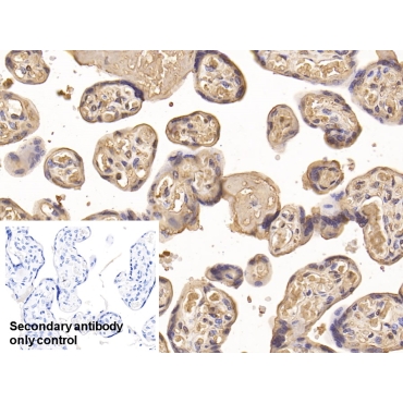 Insulin Like Growth Factor Binding Protein 1 (IGFBP1) Human Monoclonal Antibody