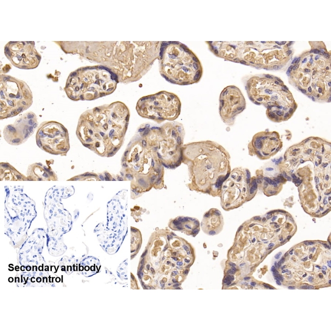 Insulin Like Growth Factor Binding Protein 1 (IGFBP1) Human Monoclonal Antibody