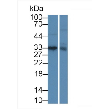 Insulin Like Growth Factor Binding Protein 1 (IGFBP1) Human Monoclonal Antibody