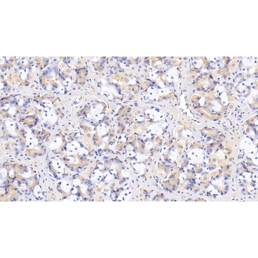 Insulin Like Growth Factor Binding Protein 1 (IGFBP1) Human Monoclonal Antibody