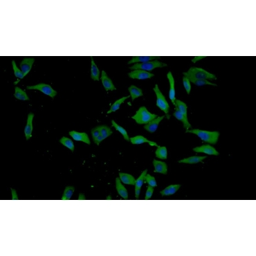 Insulin Like Growth Factor Binding Protein 1 (IGFBP1) Human Monoclonal Antibody