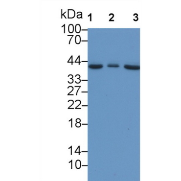 Insulin Like Growth Factor Binding Protein 3 (IGFBP3) Human Monoclonal Antibody