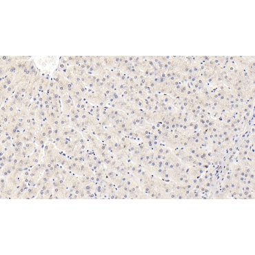 Insulin Like Growth Factor Binding Protein 3 (IGFBP3) Human Monoclonal Antibody