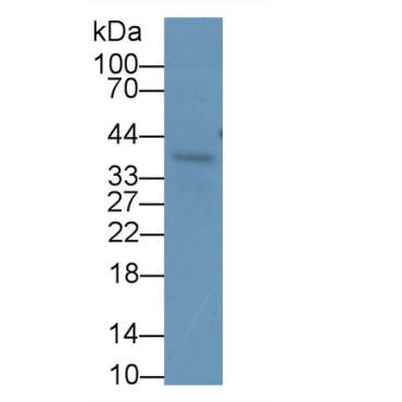 Insulin Like Growth Factor Binding Protein 3 (IGFBP3) Human Monoclonal Antibody