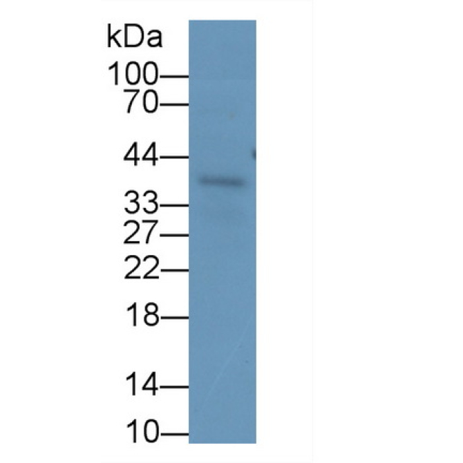 Insulin Like Growth Factor Binding Protein 3 (IGFBP3) Human Monoclonal Antibody