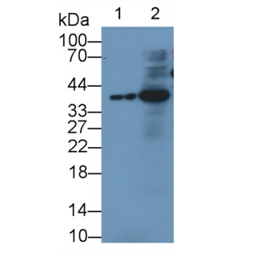 Insulin Like Growth Factor Binding Protein 3 (IGFBP3) Human Monoclonal Antibody