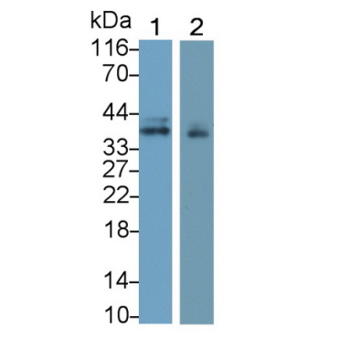 Insulin Like Growth Factor Binding Protein 3 (IGFBP3) Human Monoclonal Antibody