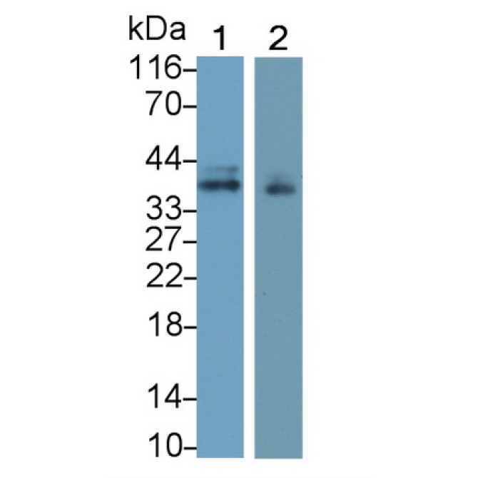 Insulin Like Growth Factor Binding Protein 3 (IGFBP3) Human Monoclonal Antibody