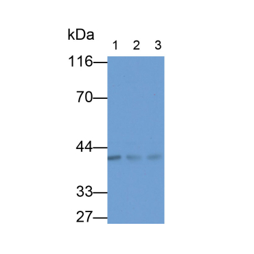 Insulin Like Growth Factor Binding Protein 3 (IGFBP3) Human Monoclonal Antibody
