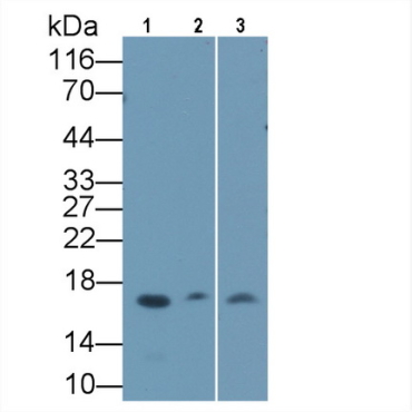 Insulin Like Growth Factor Binding Protein 4 (IGFBP4) Human Monoclonal Antibody