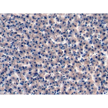 Insulin Like Growth Factor Binding Protein 4 (IGFBP4) Human Monoclonal Antibody