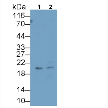 Insulin Like Growth Factor Binding Protein 4 (IGFBP4) Human Monoclonal Antibody