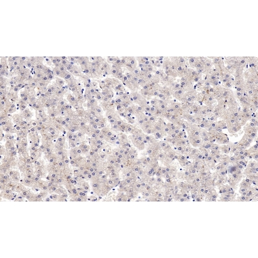 Insulin Like Growth Factor Binding Protein 4 (IGFBP4) Human Monoclonal Antibody