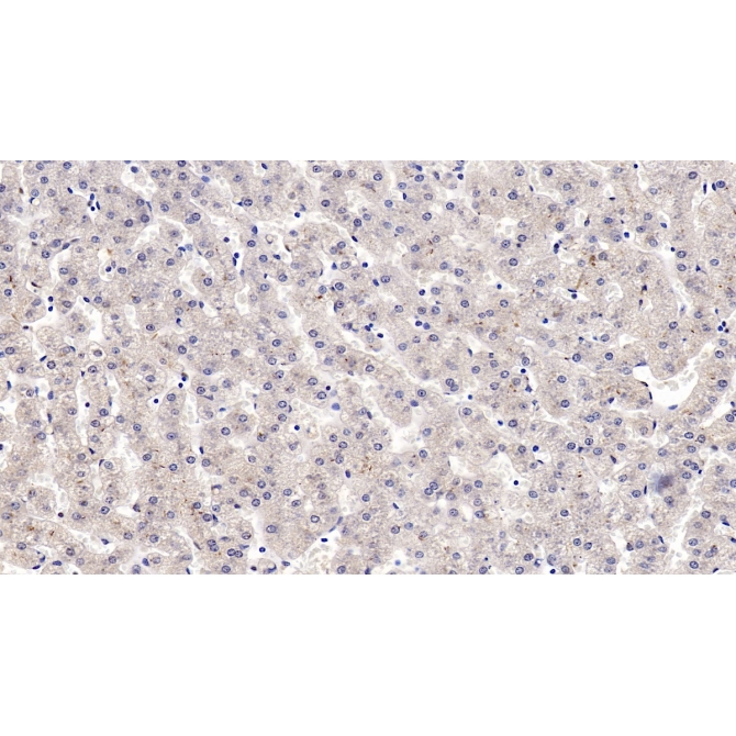 Insulin Like Growth Factor Binding Protein 4 (IGFBP4) Human Monoclonal Antibody