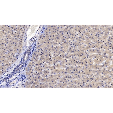 Insulin Like Growth Factor Binding Protein 4 (IGFBP4) Human Monoclonal Antibody