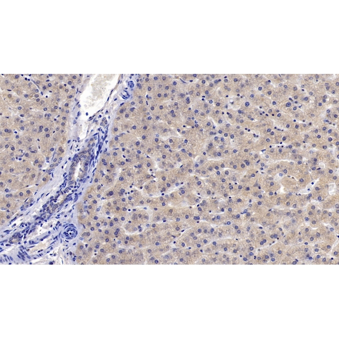 Insulin Like Growth Factor Binding Protein 4 (IGFBP4) Human Monoclonal Antibody