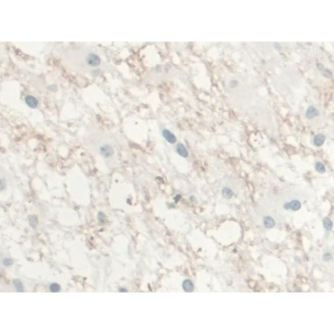 Interleukin 10 (IL10) Human Monoclonal Antibody