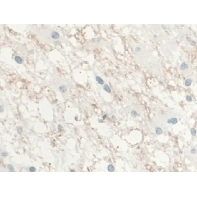 Interleukin 10 (IL10) Human Monoclonal Antibody