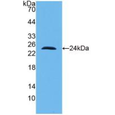 Interleukin 10 (IL10) Human Monoclonal Antibody