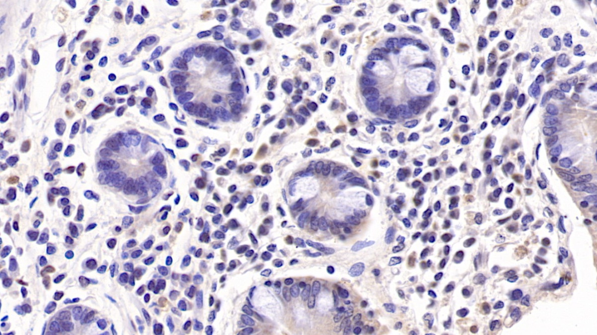 Interleukin 10 (IL10) Rabbit Monoclonal Antibody
