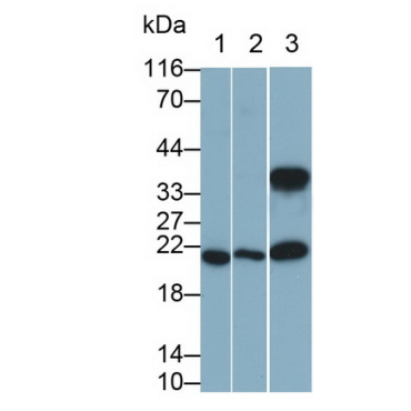 Interleukin 11 (IL11) Human Monoclonal Antibody