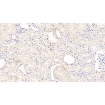 Interleukin 12B (IL12B) Human Monoclonal Antibody