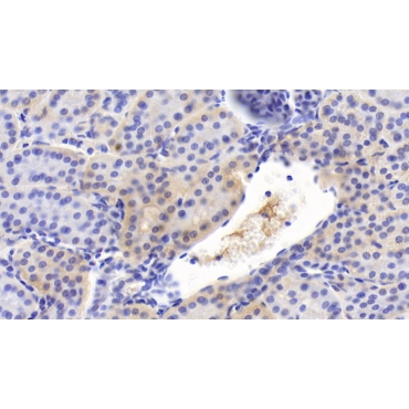 Interleukin 12B (IL12B) Human Monoclonal Antibody
