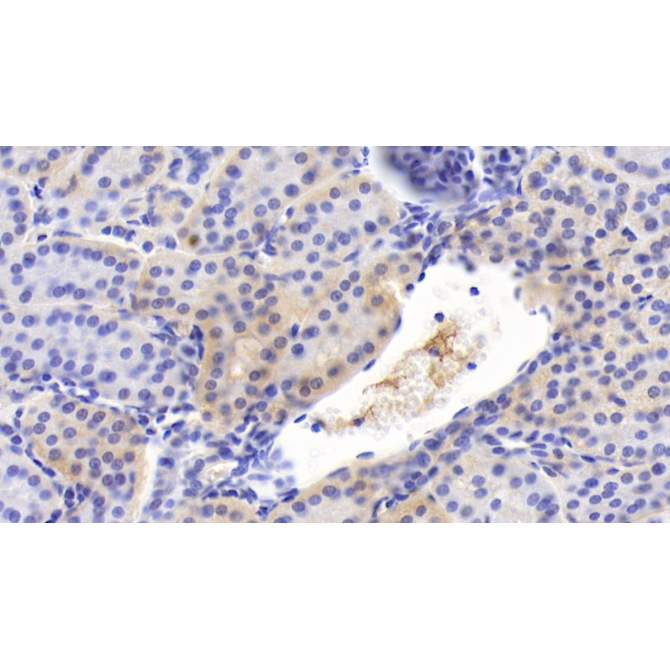 Interleukin 12B (IL12B) Human Monoclonal Antibody