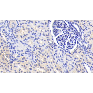 Interleukin 12B (IL12B) Human Monoclonal Antibody