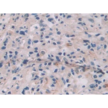 Interleukin 12A (IL12A) Human Monoclonal Antibody