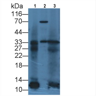 Interleukin 12A (IL12A) Human Monoclonal Antibody