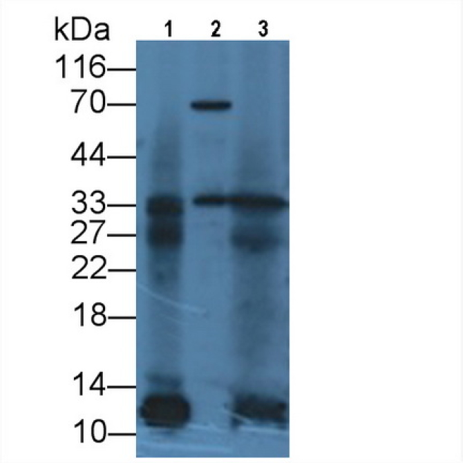 Interleukin 12A (IL12A) Human Monoclonal Antibody