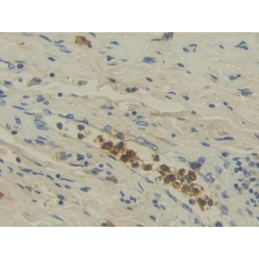 Interleukin 12A (IL12A) Human Monoclonal Antibody