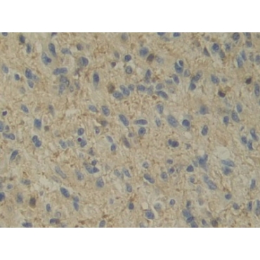 Interleukin 12A (IL12A) Human Monoclonal Antibody
