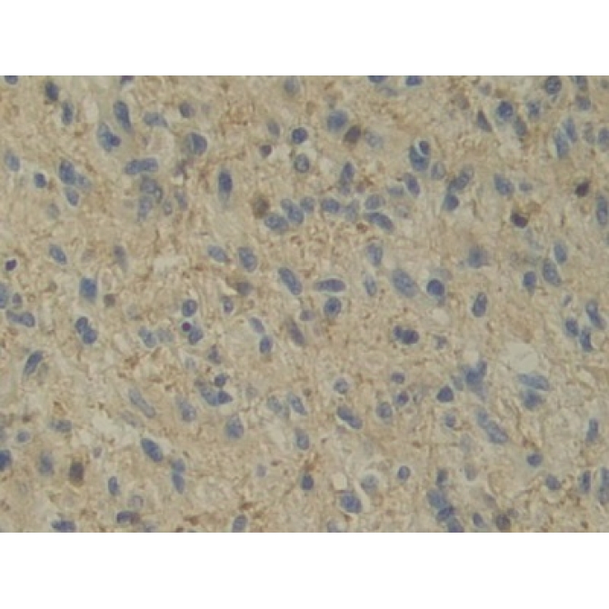 Interleukin 12A (IL12A) Human Monoclonal Antibody