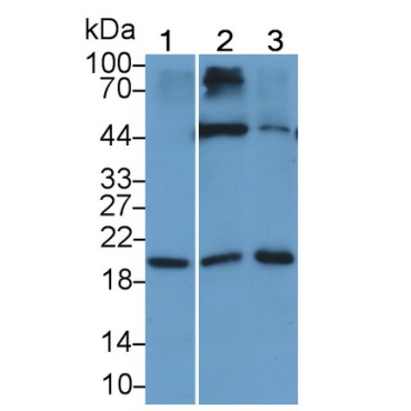 Interleukin 15 (IL15) Human Monoclonal Antibody