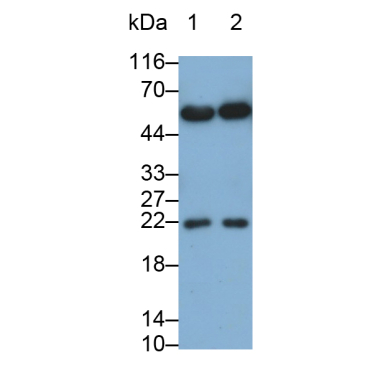 Interleukin 15 (IL15) Human Monoclonal Antibody