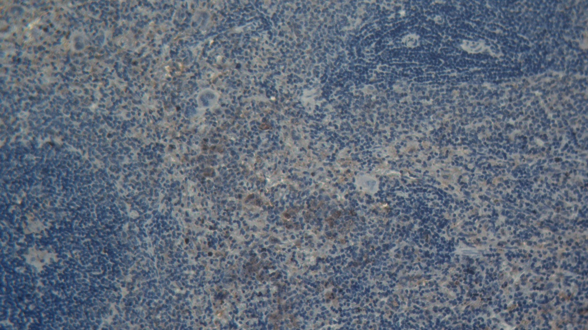 Interleukin 15 (IL15) Rat Monoclonal Antibody