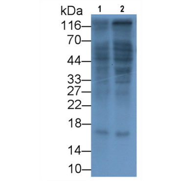 Interleukin 17 (IL17) Human Monoclonal Antibody
