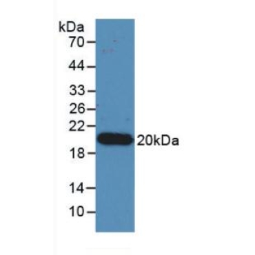 Interleukin 17 (IL17) Human Monoclonal Antibody