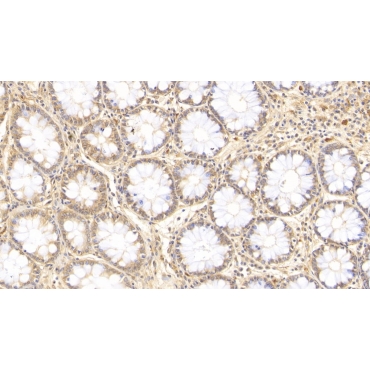 Interleukin 17 (IL17) Human Monoclonal Antibody
