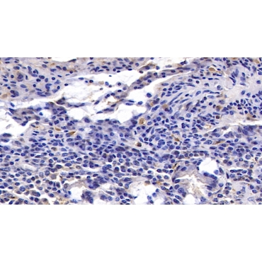 Interleukin 17 (IL17) Human Monoclonal Antibody