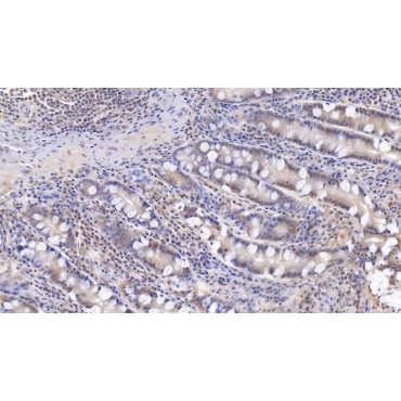 Interleukin 17 (IL17) Human Monoclonal Antibody