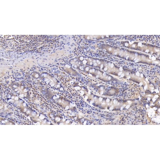 Interleukin 17 (IL17) Human Monoclonal Antibody