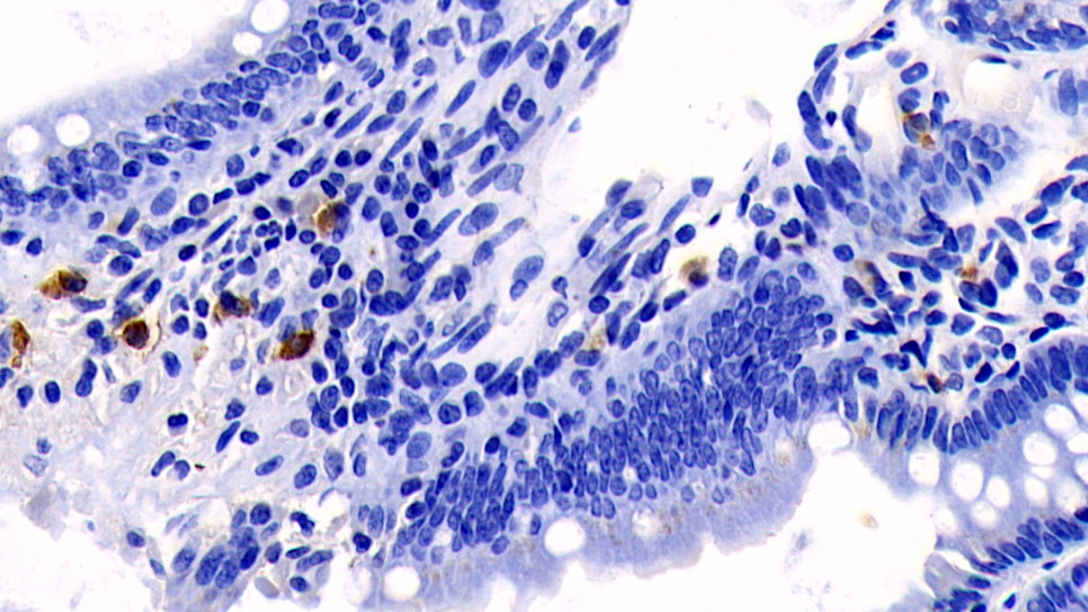 Interleukin 17 (IL17) Rat Monoclonal Antibody