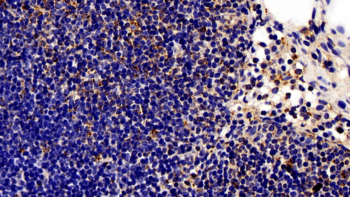 Interleukin 17 (IL17) Rat Monoclonal Antibody