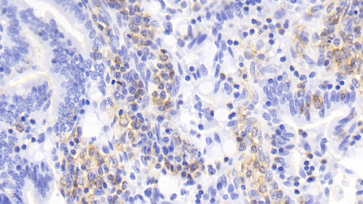 Interleukin 17 (IL17) Rabbit Monoclonal Antibody