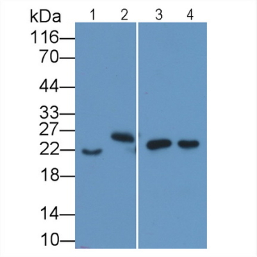 Interleukin 18 (IL18) Human Monoclonal Antibody