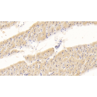 Interleukin 18 (IL18) Human Monoclonal Antibody