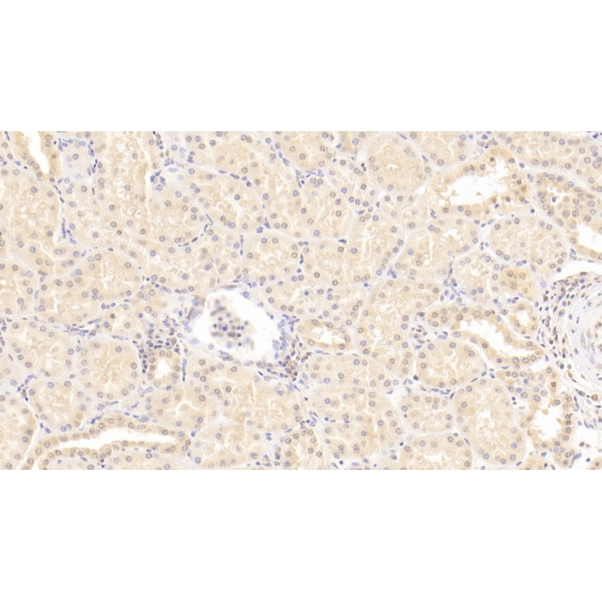 Interleukin 18 (IL18) Human Monoclonal Antibody